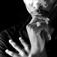 ringe_konvexkonkav_oval'2 Porträtaufnahme eines Mannes, der zwei massive Siegelringe mit ovaler Siegelplatte trägt. Eine ist konkav, die andere konvex gewölbt.