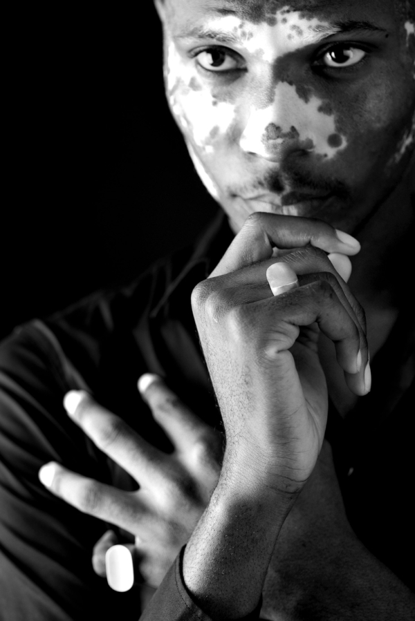 ringe_konvexkonkav_oval'2 Porträtaufnahme eines Mannes, der zwei massive Siegelringe mit ovaler Siegelplatte trägt. Eine ist konkav, die andere konvex gewölbt.